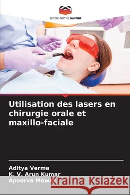 Utilisation des lasers en chirurgie orale et maxillo-faciale Aditya Verma K. V. Aru Apoorva Mowar 9786207745029 Editions Notre Savoir - książka