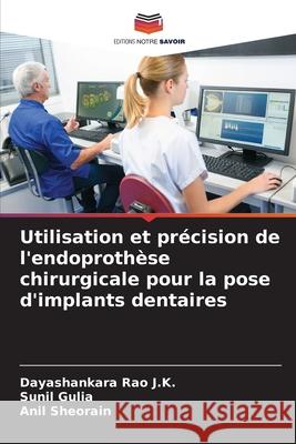 Utilisation et précision de l'endoprothèse chirurgicale pour la pose d'implants dentaires Rao J.K., Dayashankara, Gulia, Sunil, Sheorain, Anil 9786208687472 Editions Notre Savoir - książka