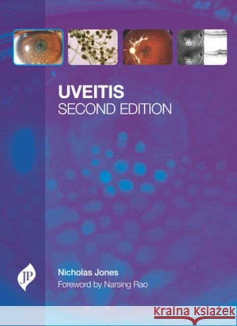 Uveitis Nicholas P Jones 9781907816185  - książka