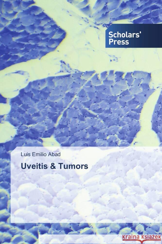 Uveitis & Tumors Abad, Luis Emilio 9786202312738 Scholars' Press - książka