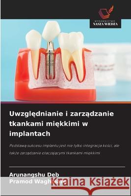 Uwzglednianie i zarzadzanie tkankami miekkimi w implantach Deb, Arunangshu, Waghmare, Pramod 9786208467470 Wydawnictwo Nasza Wiedza - książka