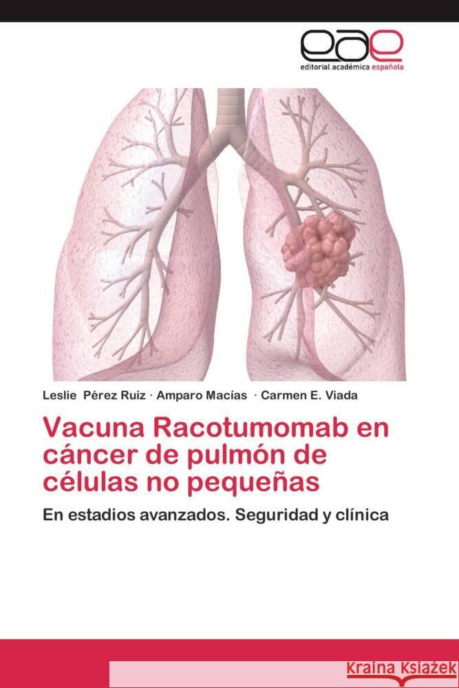 Vacuna Racotumomab en cáncer de pulmón de células no pequeñas : En estadios avanzados. Seguridad y clínica Pérez Ruiz, Leslie; Macías, Amparo; Viada, Carmen E. 9783659057304 Editorial Académica Española - książka