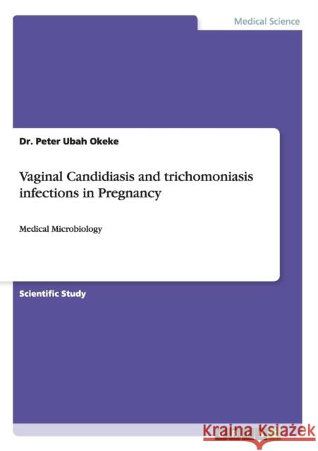Vaginal Candidiasis and trichomoniasis infections in Pregnancy: Medical Microbiology Okeke, Peter Ubah 9783656481638 Grin Verlag - książka