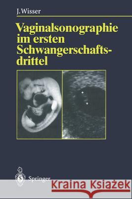 Vaginalsonographie Im Ersten Schwangerschaftsdrittel Wisser, Josef 9783642798139 Springer - książka