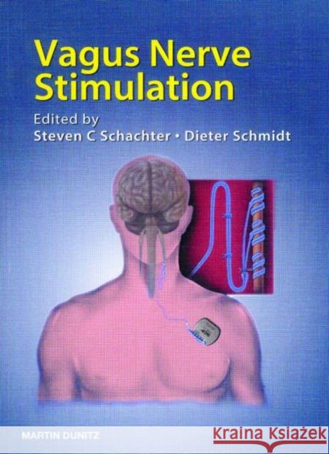 vagus nerve stimulation  Schachter, Steven C. 9781841842578 Taylor & Francis Group - książka
