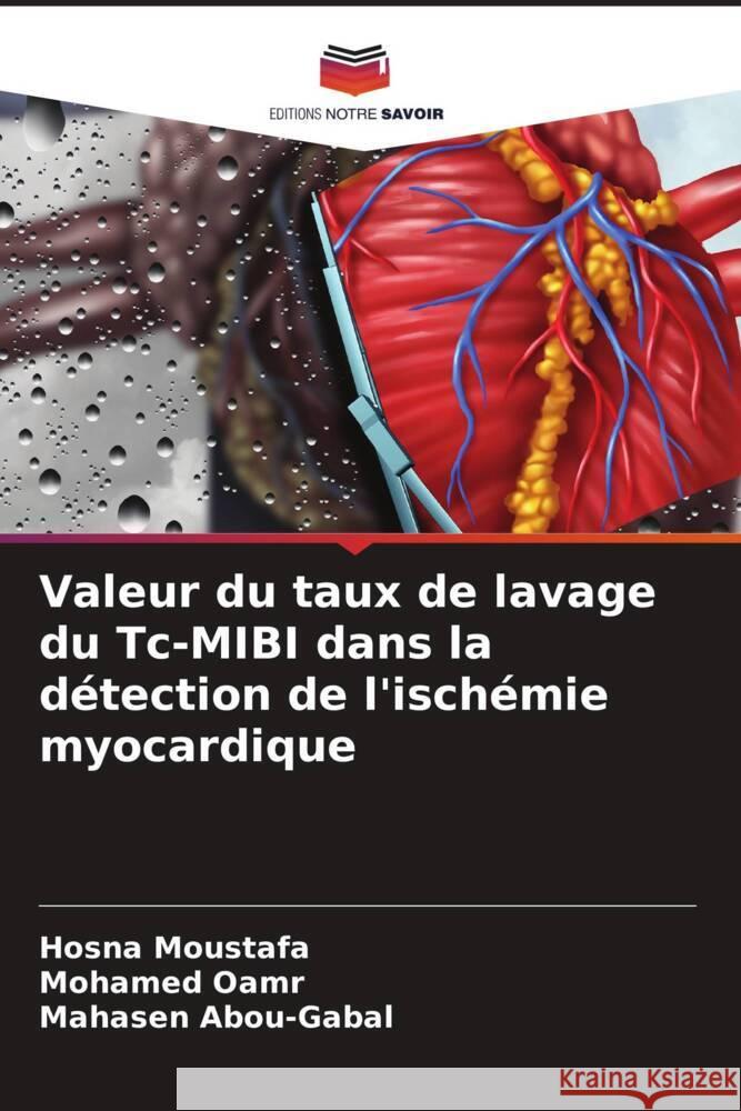 Valeur du taux de lavage du Tc-MIBI dans la d?tection de l'isch?mie myocardique Hosna Moustafa Mohamed Oamr Mahasen Abou-Gabal 9786206903017 Editions Notre Savoir - książka