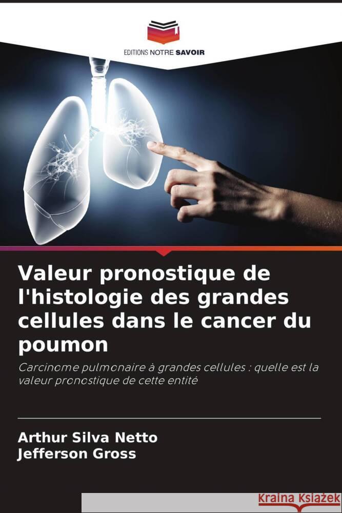 Valeur pronostique de l'histologie des grandes cellules dans le cancer du poumon Arthur Silv Jefferson Gross 9786207226436 Editions Notre Savoir - książka