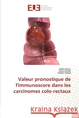 Valeur pronostique de l'immunoscore dans les carcinomes colo-rectaux Helal, Imen, Jouini, Raja, HMIDI, AMIRA 9786206724803 Éditions universitaires européennes - książka