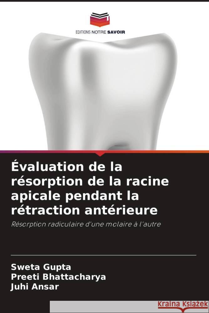 Évaluation de la résorption de la racine apicale pendant la rétraction antérieure Gupta, Sweta, Bhattacharya, Preeti, Ansar, Juhi 9786134977890 Editions Notre Savoir - książka