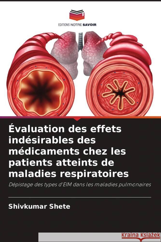 Évaluation des effets indésirables des médicaments chez les patients atteints de maladies respiratoires Shete, Shivkumar 9786205428511 Editions Notre Savoir - książka