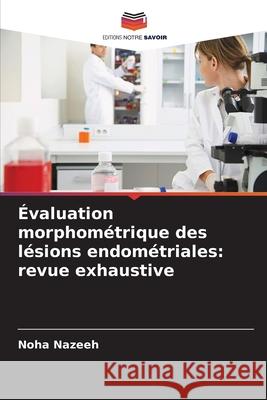 Évaluation morphométrique des lésions endométriales: revue exhaustive Nazeeh, Noha 9786209125324 Editions Notre Savoir - książka