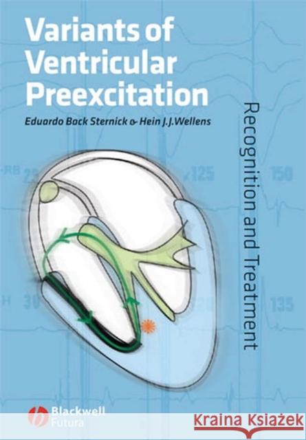 Variants of Ventricular Preexcitation: Recognition and Treatment Back Sternick, Eduardo 9781405148436 Blackwell Publishers - książka