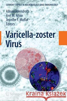 Varicella-Zoster Virus Abendroth, Allison 9783642264665 Springer - książka