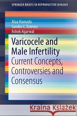 Varicocele and Male Infertility: Current Concepts, Controversies and Consensus Hamada, Alaa 9783319249346 Springer - książka