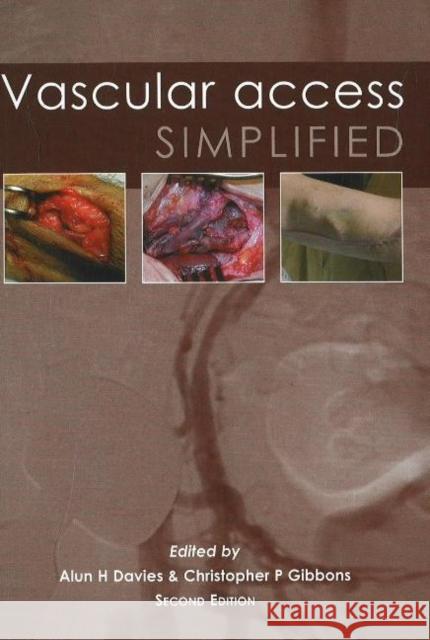 Vascular Access Simplified; Second Edition Davies, Alun H. 9781903378526 TFM PUBLISHING LTD - książka
