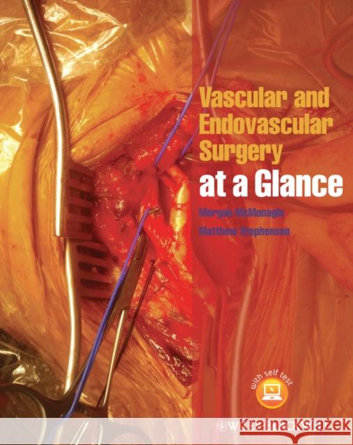 Vascular and Endovascular Surgery at a Glance McMonagle, Morgan; Stephenson, Matthew 9781118496039 John Wiley & Sons - książka