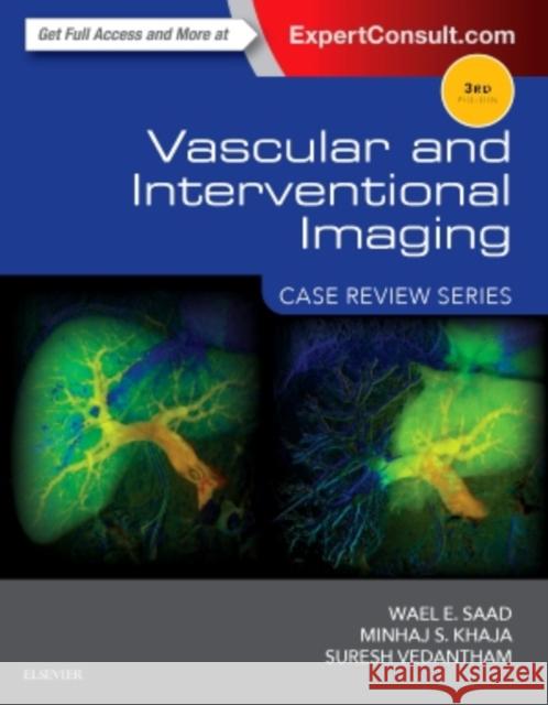 Vascular and Interventional Imaging: Case Review Series Wael E. A. Saad Minhaj Khaja Suresh Vedantham 9781455776306 Elsevier - książka