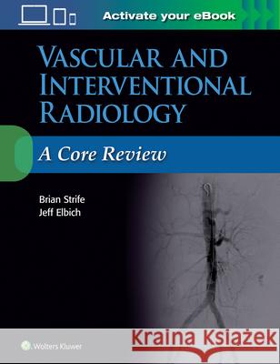 Vascular and Interventional Radiology: A Core Review Brian Strife Jeffrey Elbich 9781496384393 LWW - książka