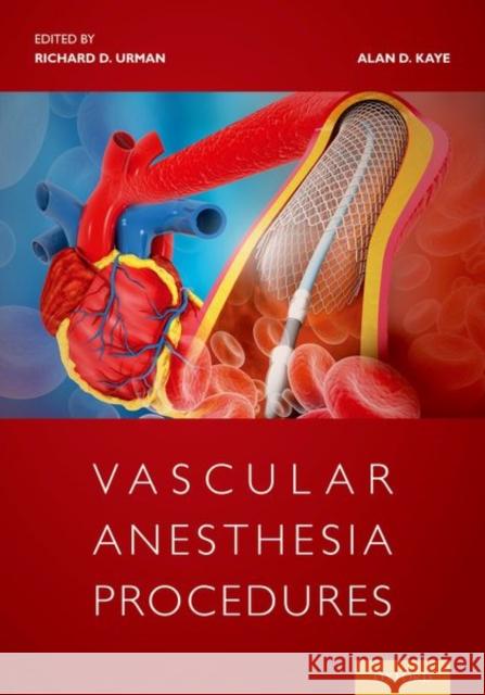 Vascular Anesthesia Procedures Richard Urman, MD (Associate Professor o Alan Kaye (Professor of Anesthesiology a  9780197506073 Oxford University Press Inc - książka