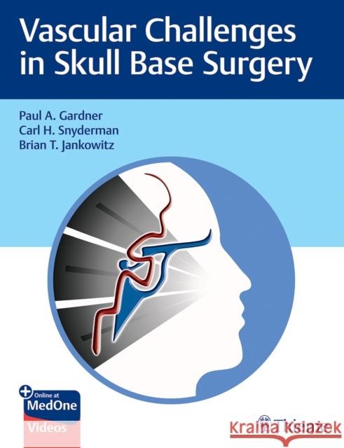 Vascular Challenges in Skull Base Surgery Paul Gardner Carl Snyderman Brian Jankowitz 9781684200689 Thieme Medical Publishers - książka