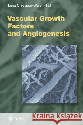 Vascular Growth Factors and Angiogenesis Lena Claesson-Welsh 9783642641954 Springer-Verlag Berlin and Heidelberg GmbH &  - książka