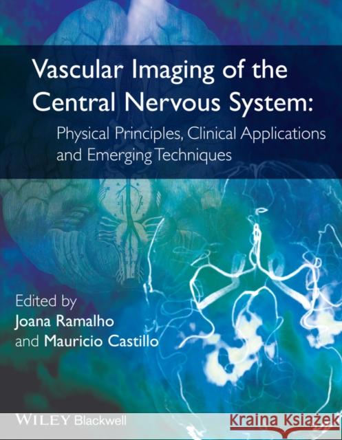 Vascular Imaging of the Central Nervous System: Physical Principles, Clinical Applications, and Emerging Techniques Ramalho, Joana 9781118188750 John Wiley & Sons - książka