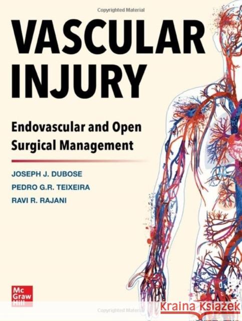 Vascular Injury: Endovascular and Open Surgical Management Joe Dubose Pedro G. Teixeira Ravi R. Rajani 9781264269822 McGraw Hill / Medical - książka