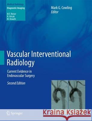 Vascular Interventional Radiology: Current Evidence in Endovascular Surgery Cowling, Mark G. 9783642278778 Springer - książka