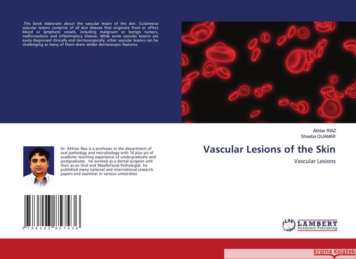 Vascular Lesions of the Skin Riaz, Akhtar, QUAMAR, SHEEBA 9786203857436 LAP Lambert Academic Publishing - książka