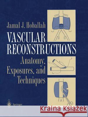 Vascular Reconstructions: Anatomy, Exposures and Techniques Hoballah, Jamal J. 9781475774337 Springer - książka