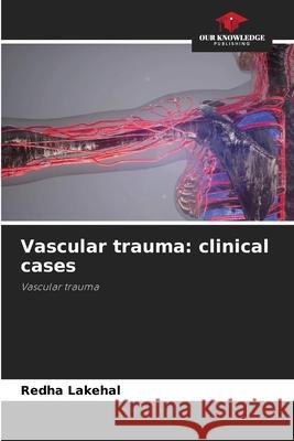 Vascular trauma: clinical cases Redha Lakehal 9786205355497 Our Knowledge Publishing - książka