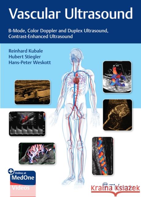 Vascular Ultrasound R Kubale 9783132405431 Thieme Publishing Group - książka