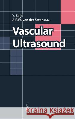 Vascular Ultrasound  9784431703280 SPRINGER VERLAG, JAPAN - książka