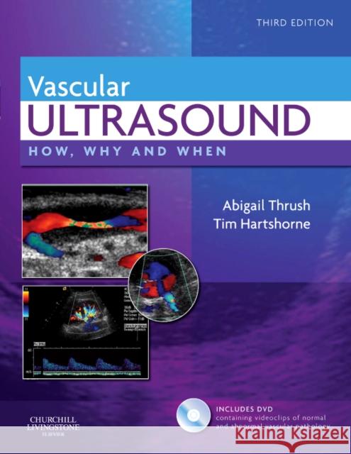 Vascular Ultrasound: How, Why and When Abigail Thrush 9780443069185 CHURCHILL LIVINGSTONE - książka
