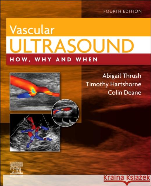 Vascular Ultrasound: How, Why and When  9780702046568 Elsevier Health Sciences - książka