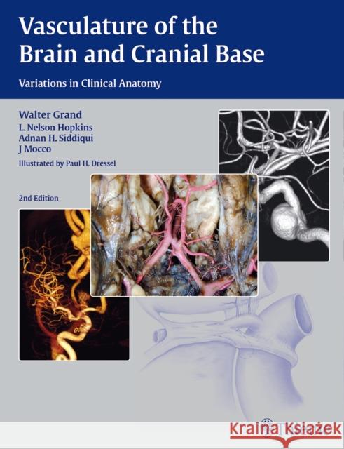 Vasculature of the Brain and Cranial Base Walter Grand L. N. Hopkins Adnan Siddiqui 9781604068856 Thieme Medical Publishers - książka