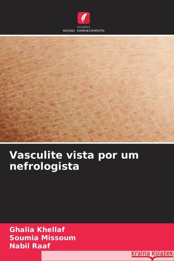 Vasculite vista por um nefrologista Ghalia Khellaf Soumia Missoum Nabil Raaf 9786206869429 Edicoes Nosso Conhecimento - książka