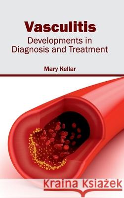 Vasculitis: Developments in Diagnosis and Treatment Mary Kellar 9781632413819 Hayle Medical - książka