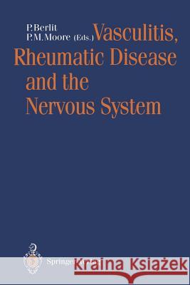 Vasculitis, Rheumatic Disease and the Nervous System Peter Berlit Patricia Moore 9783540548539 Springer - książka