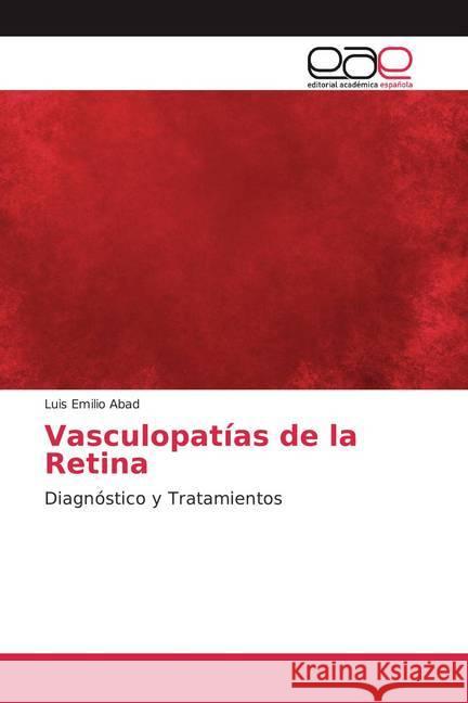 Vasculopatías de la Retina : Diagnóstico y Tratamientos Abad, Luis Emilio 9786139117017 Editorial Académica Española - książka