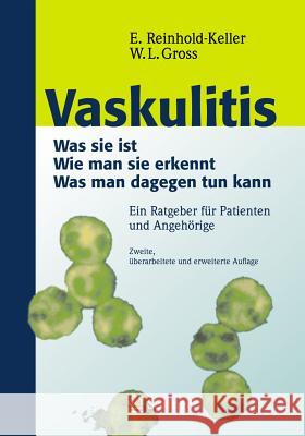 Vaskulitis: Was Ist Sie - Wie Man Sie Erkennt - Was Man Dagegen Tun Kann Reinhold-Keller, Eva 9783798514744 Steinkopff - książka