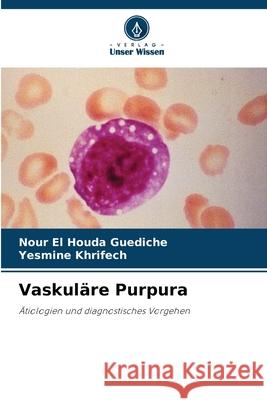 Vaskuläre Purpura Guediche, Nour El Houda, Khrifech, Yesmine 9786209493362 Verlag Unser Wissen - książka