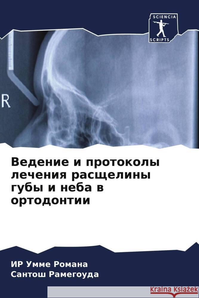Vedenie i protokoly lecheniq rasscheliny guby i neba w ortodontii Romana, IR Umme, Ramegouda, Santosh 9786204419350 Sciencia Scripts - książka