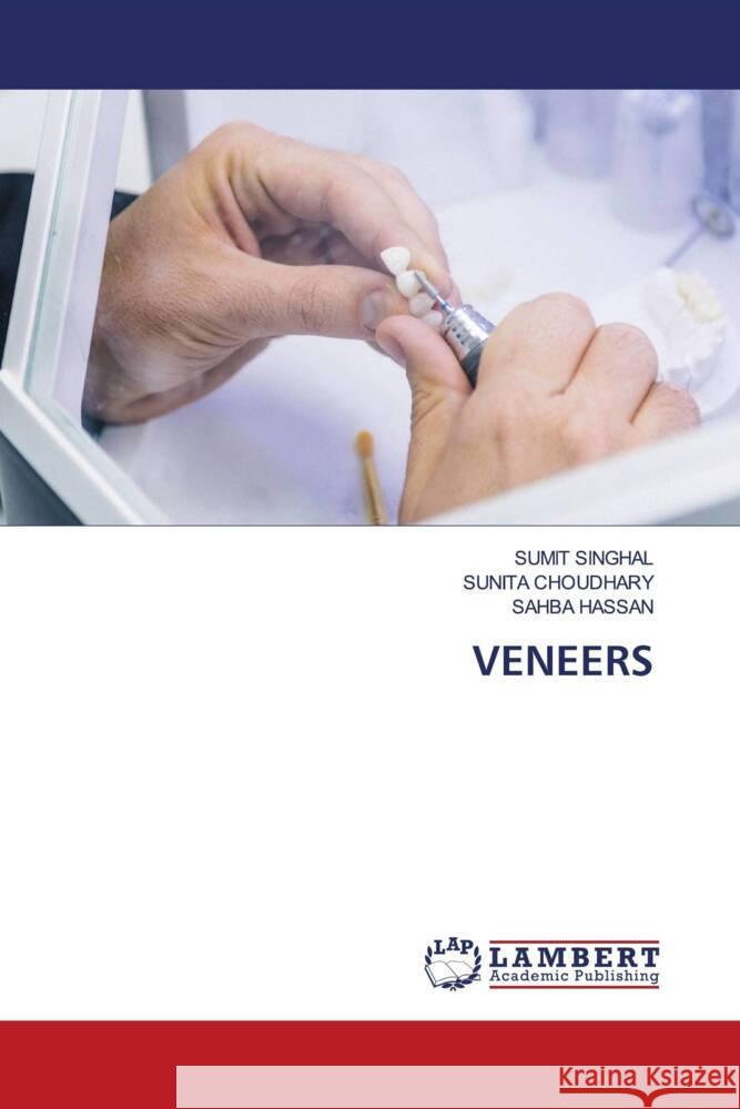 VENEERS SINGHAL, SUMIT, Choudhary, Sunita, Hassan, Sahba 9783659393365 LAP Lambert Academic Publishing - książka