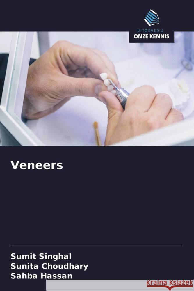Veneers SINGHAL, SUMIT, Choudhary, Sunita, Hassan, Sahba 9786208317126 Uitgeverij Onze Kennis - książka