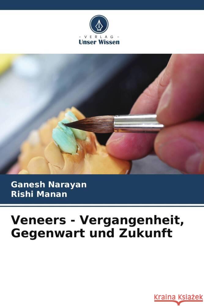 Veneers - Vergangenheit, Gegenwart und Zukunft Narayan, Ganesh, Manan, Rishi 9786206576532 Verlag Unser Wissen - książka