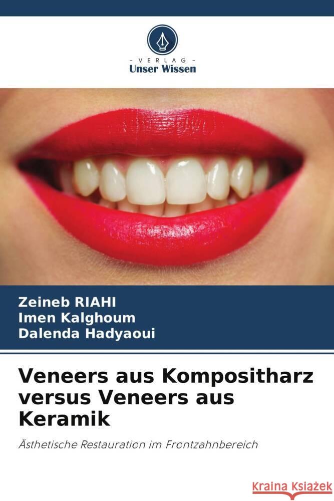 Veneers aus Kompositharz versus Veneers aus Keramik Riahi, Zeineb, Kalghoum, Imen, Hadyaoui, Dalenda 9786208587901 Verlag Unser Wissen - książka