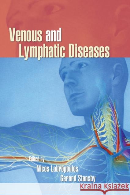 Venous and Lymphatic Diseases Nicos Labropoulos Gerard Stansby 9780824729233 Taylor & Francis - książka