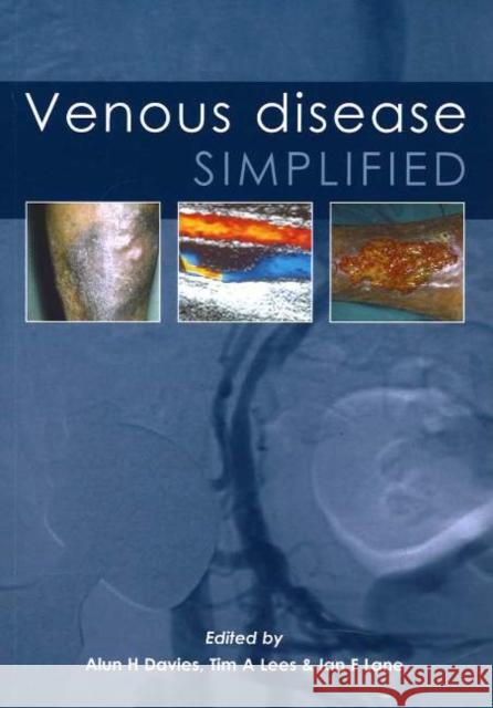 Venous Disease Simplified  9781903378250 TFM PUBLISHING LTD - książka