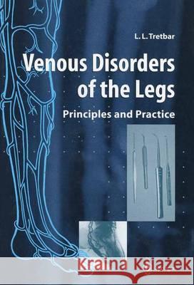 Venous Disorders of the Legs: Principles and Practice Tretbar, Lawrence L. 9781447112037 Springer - książka